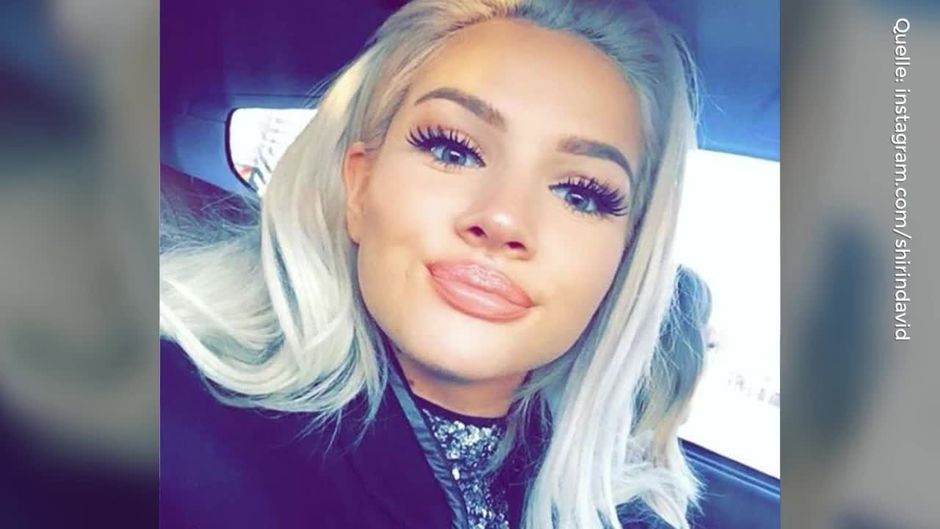 Geheimnis gelüftet: So sieht Shirin David unter ihrer Perücke aus | ProSieben