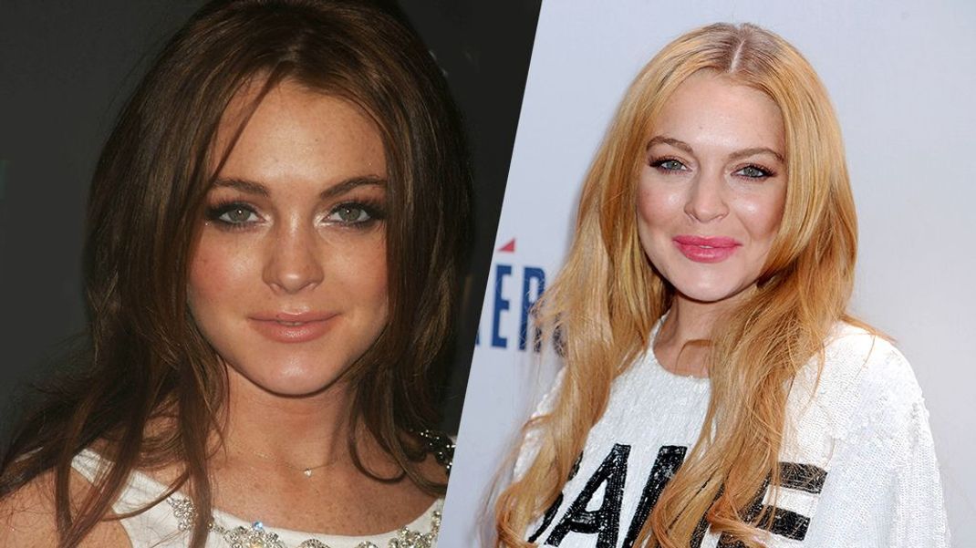 Drogen und Alkohol war sie nicht abgeneigt, aber auch zu Botox und Aufpolsterungen sagte Lindsay Lohan wohl nicht Nein.