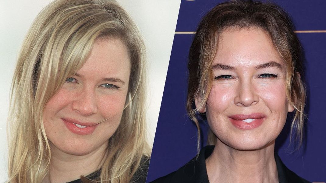 Vom süßen Bridget-Jones-Look ist heute bei Renée Zellweger nichts mehr zu sehen.