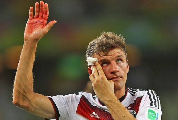 
                <strong>Nur die Harten kommen in den Garten</strong><br>
                Sekunden vor dem Abpfiff beim Duell Deutschland gegen Ghana: Thomas Müller prallt unglücklich mit Gegenspieler Boye zusammen. Schrecksekunde: Mit einer blutenden Kopfwunde bleibt er liegen. Aber Müller ist hart im Nehmen, erleidet nur einen Cut unter der Augenbraue. 
              