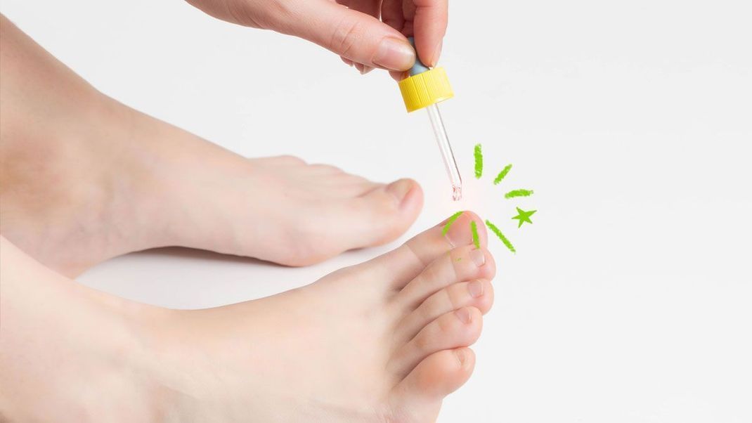 Warme, dichte Winterstiefel und dicke Socken können Pilzerkrankungen an den Füßen begünstigen - wir haben die besten Tipps gegen Nagelpilz parat!
