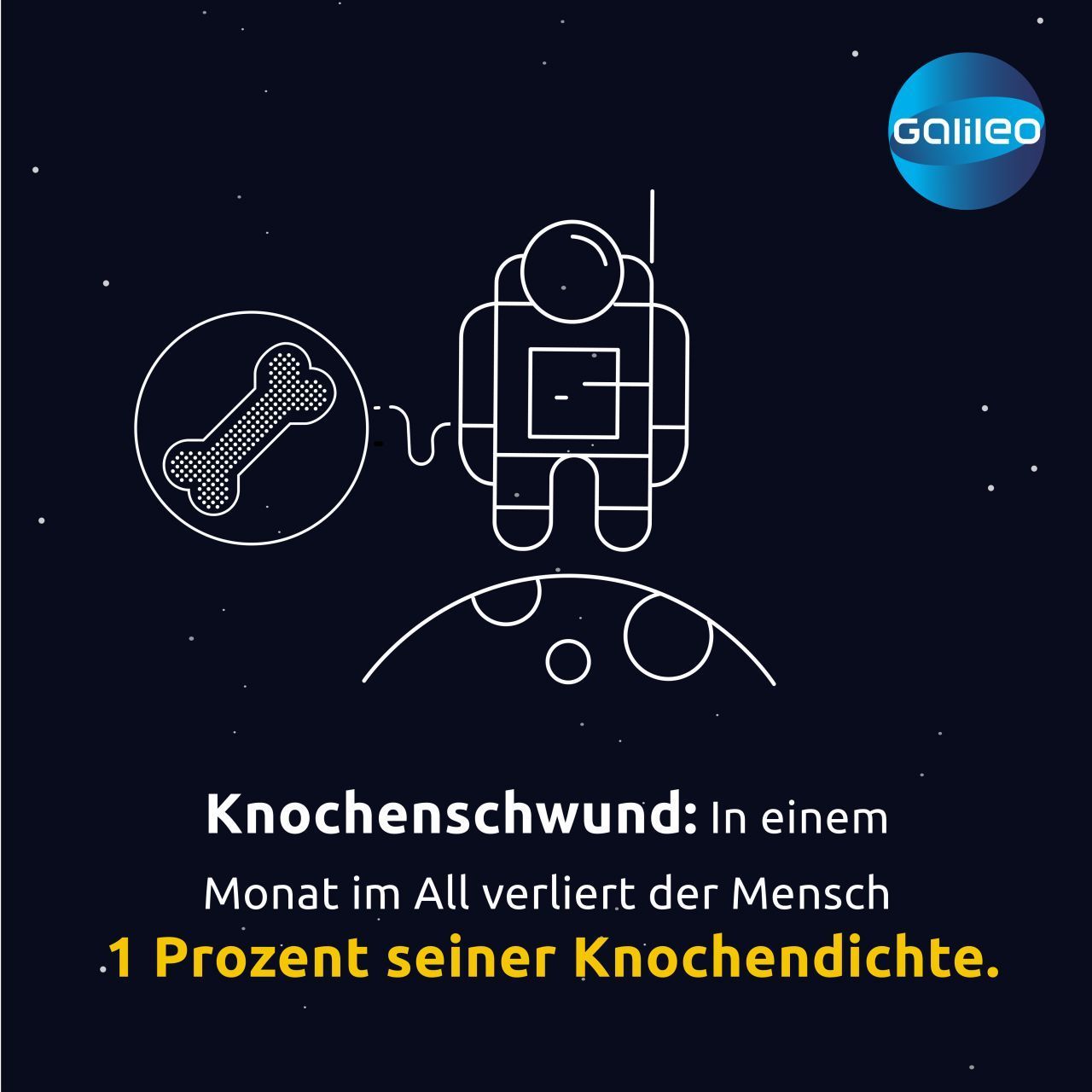 Das macht die Raumfahrt mit dem Körper von Astronauten