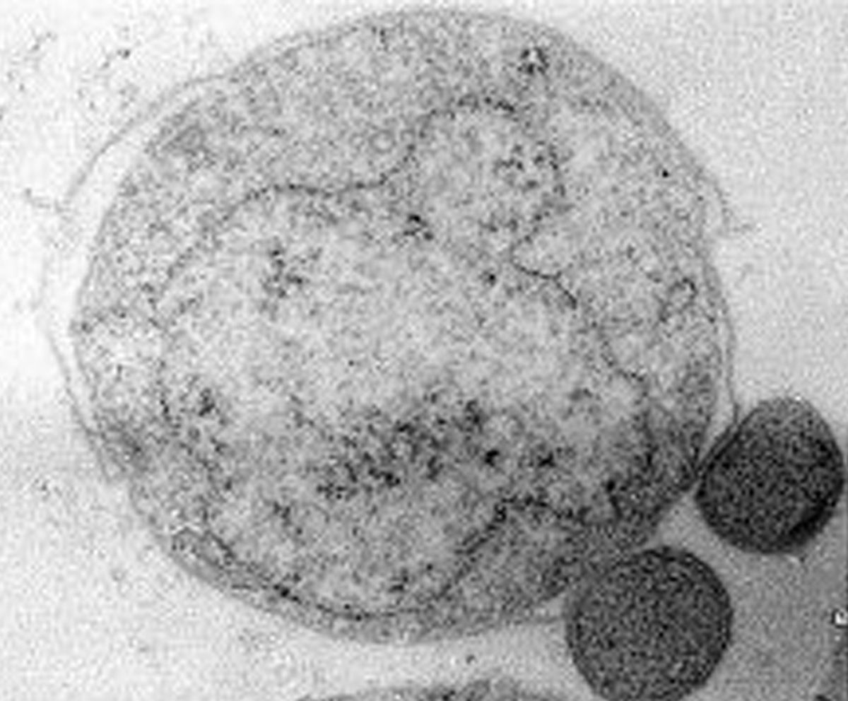 Nanoarchaeum equitans ist mit etwa 0,0004 Millimetern das kleinste Lebewesen der Welt. Du bist also etwa acht Millionen Mal größer. Schon menschliche Hautzellen sind über 100 Mal größer.