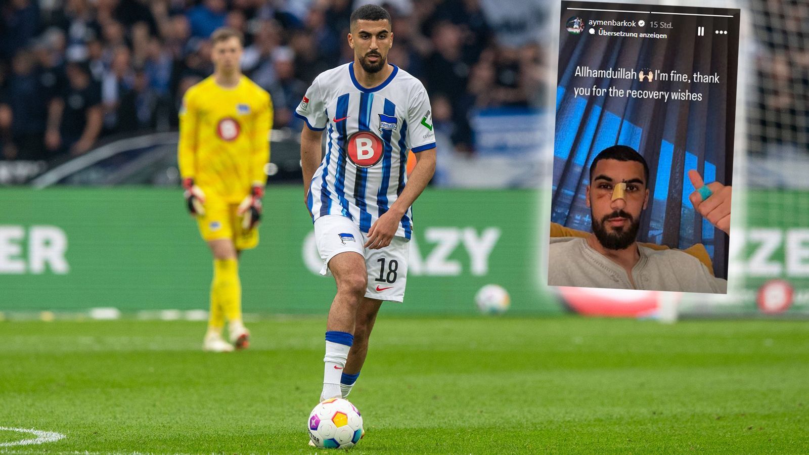 <strong>Aymen Barkok (Hertha BSC)</strong><br>Nach dem <a href="https://www.ran.de/sports/fussball/2-bundesliga/news/hertha-bsc-aymen-barkok-attackiert-operation-und-zwangspause-noetig-363706">Angriff in einem Berliner Lokal vor etwas mehr als einer Woche inklusive anschließender OP hat sich Hertha-Profi Aymen Barkok</a> erstmals zu Wort gemeldet. In seiner Instagram-Story postete die Mainz-Leihgabe ein Foto von sich mit Schrammen im Gesicht und schrieb dazu: "Gott sei Dank. Mir geht es gut, danke für die Genesungswünsche."