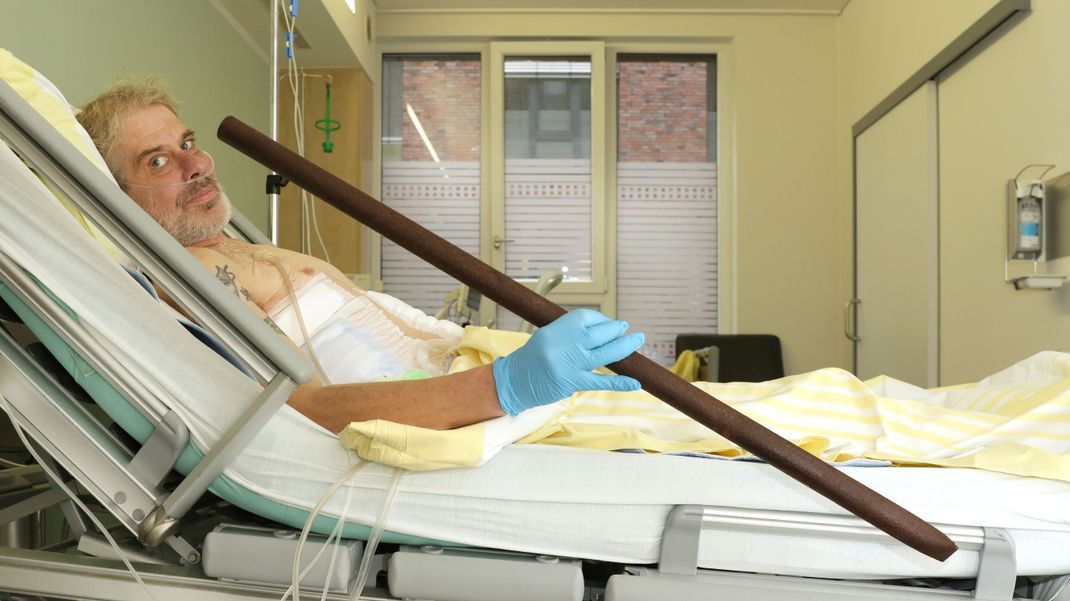 Patient Frank Vaorin hält die Zaunstange in der Hand, die seinen Körper durchbohrte. 
