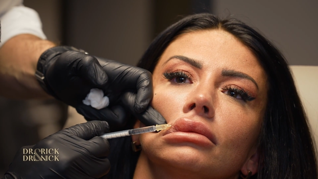 Christina Dimitriou schockiert mit ihrer Lippenveränderung bei "Dr. Rick & Dr. Nick"
