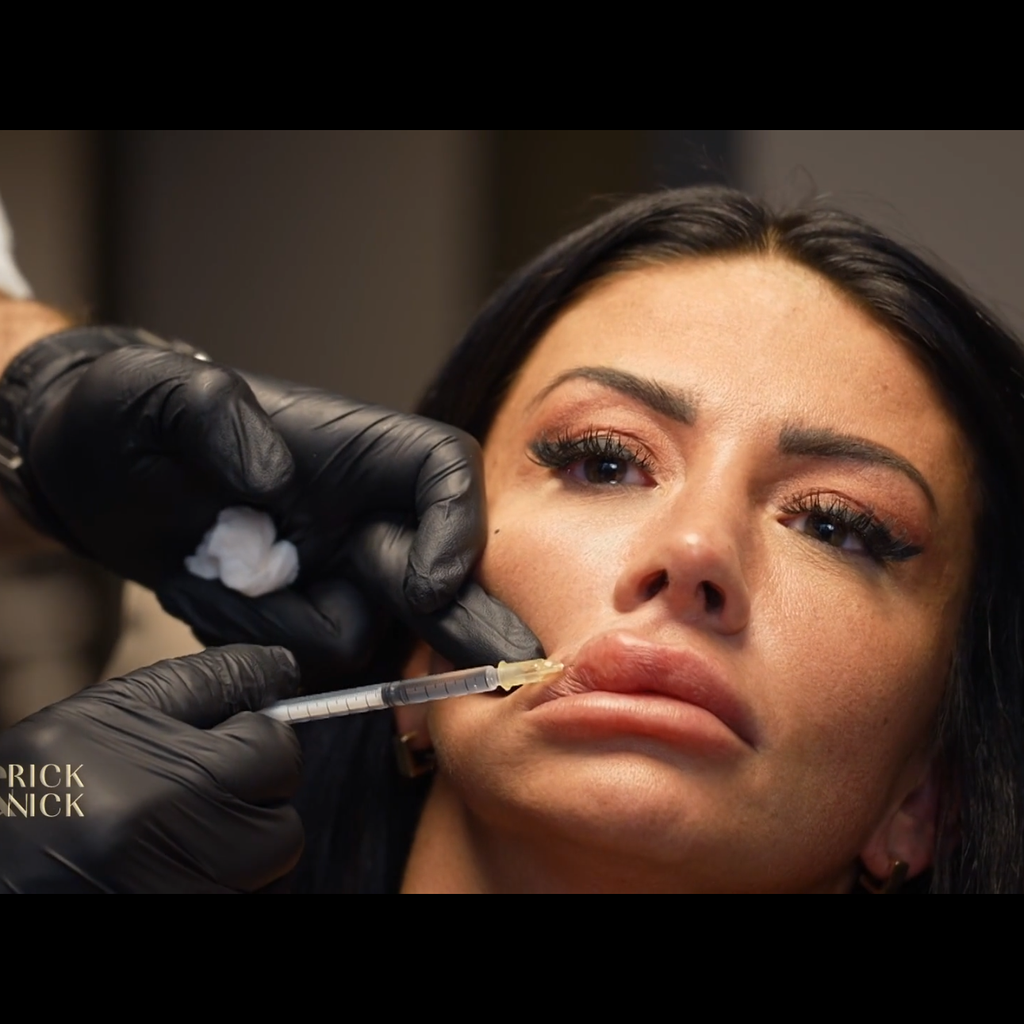 Christina Dimitriou schockiert mit ihrer Lippenveränderung bei "Dr. Rick & Dr. Nick"