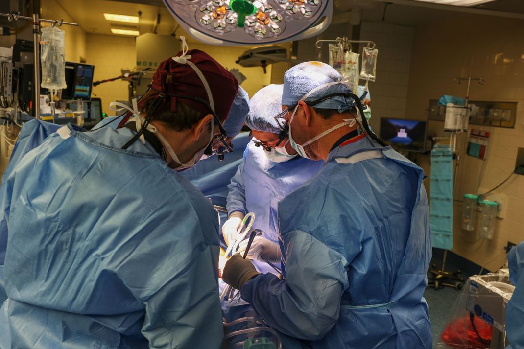 Der weltweit erste Patient mit einer transplantierten Schweineniere ist knapp zwei Monate nach der Operation gestorben. 