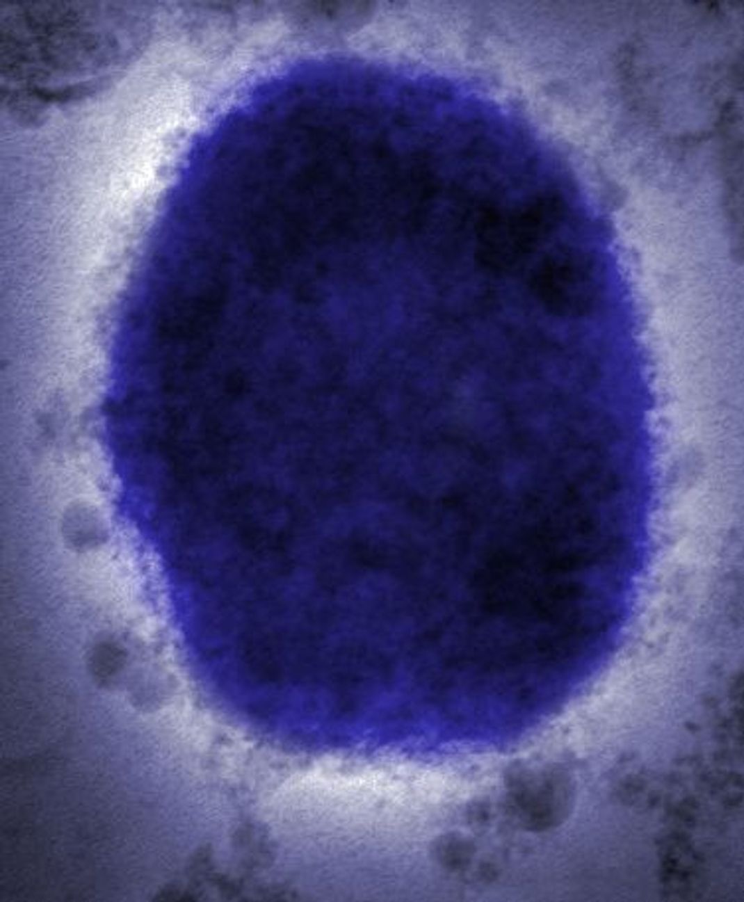 Affenpocken-Virus in der Mikroskop-Ansicht