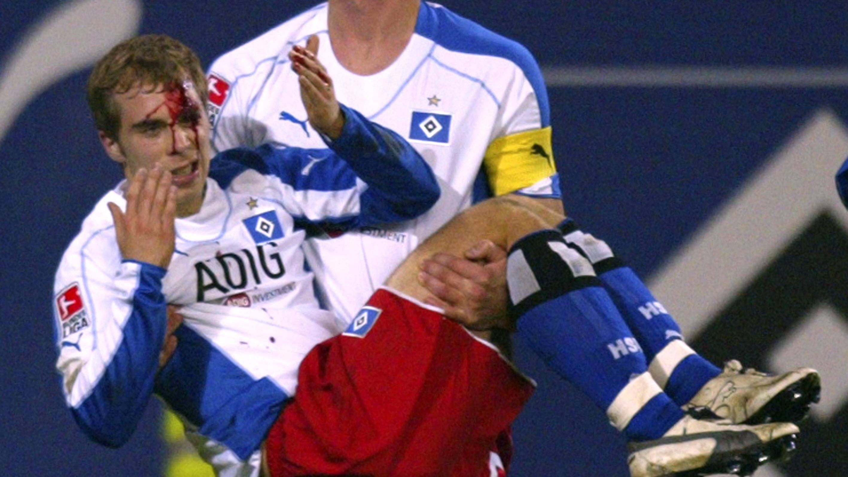 <strong>Alexander Laas: Bundesliga 2005, 1. FC Köln - Hamburger SV</strong><br>Daniel van Buyten trägt den verletzten Alexander Laas (beide HSV) aus der Gefahrenzone. Ein Trommelstock, der von einem Kölner Fan geworfen wurde, traf den HSV Spieler im Gesicht. Laas erlitt dadurch eine ein bis zwei Zentimeter lange Platzwunde.&nbsp;