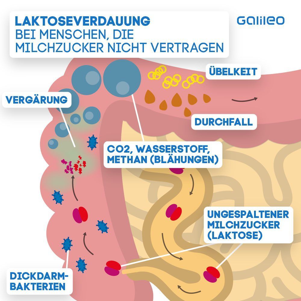 Laktoseintoleranz: Das passiert in deinem Bauch - oder eben nicht