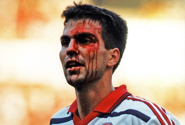 
                <strong>Markus Babbel (FC Bayern München)</strong><br>
                Dem damaligen Teamkollegen des Nationaltorwarts ging nicht besser. Der ehemalige Innenverteidiger des deutschen Rekordmeisters Markus Babbel musste das Feld mit blutüberströmten Gesicht verlassen.
              