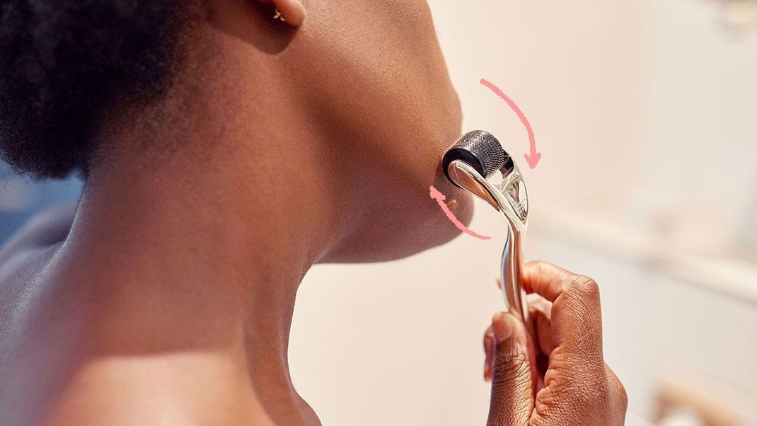 Micro Needling: Was steckt hinter dem Beauty-Trend? Was solltet ihr bei der Handhabung mit dem Dermaroller beachten? Wir haben die Antworten für euch!