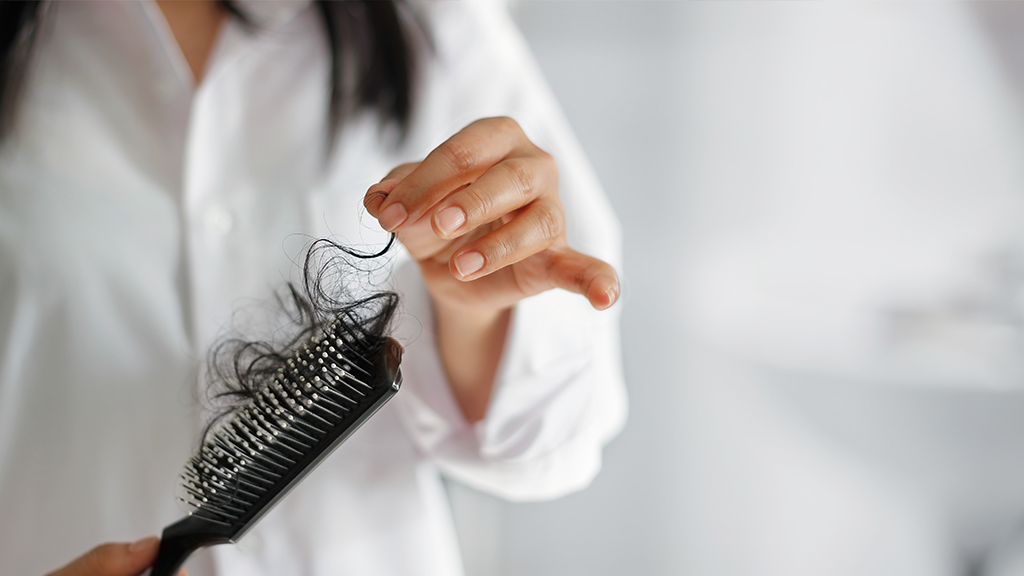 Reine Kopfsache: So funktioniert eine Haartransplantation bei Haarausfall