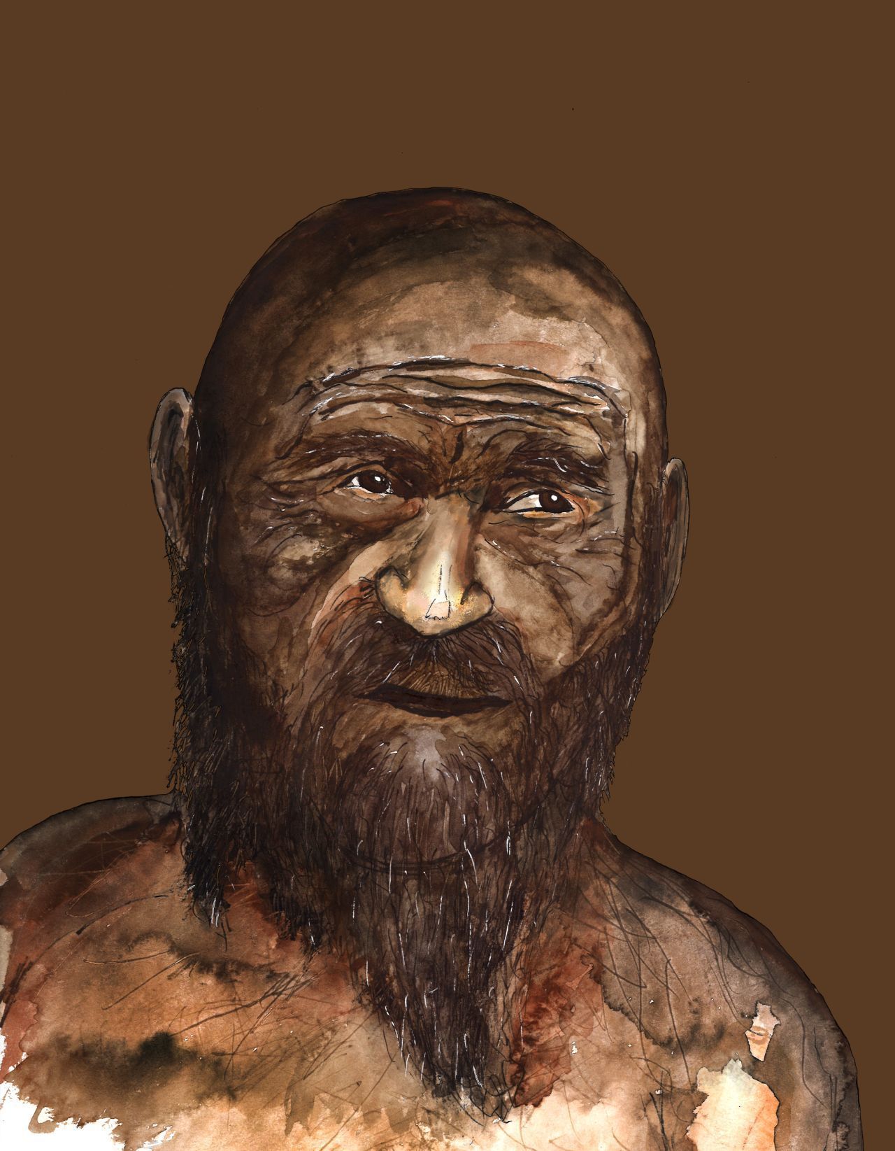 Ötzi litt wohl unter Haarausfall und hatte vermutlich eine Glatze. Die Hautfarbe war wohl weniger hell als bisher angenommen.