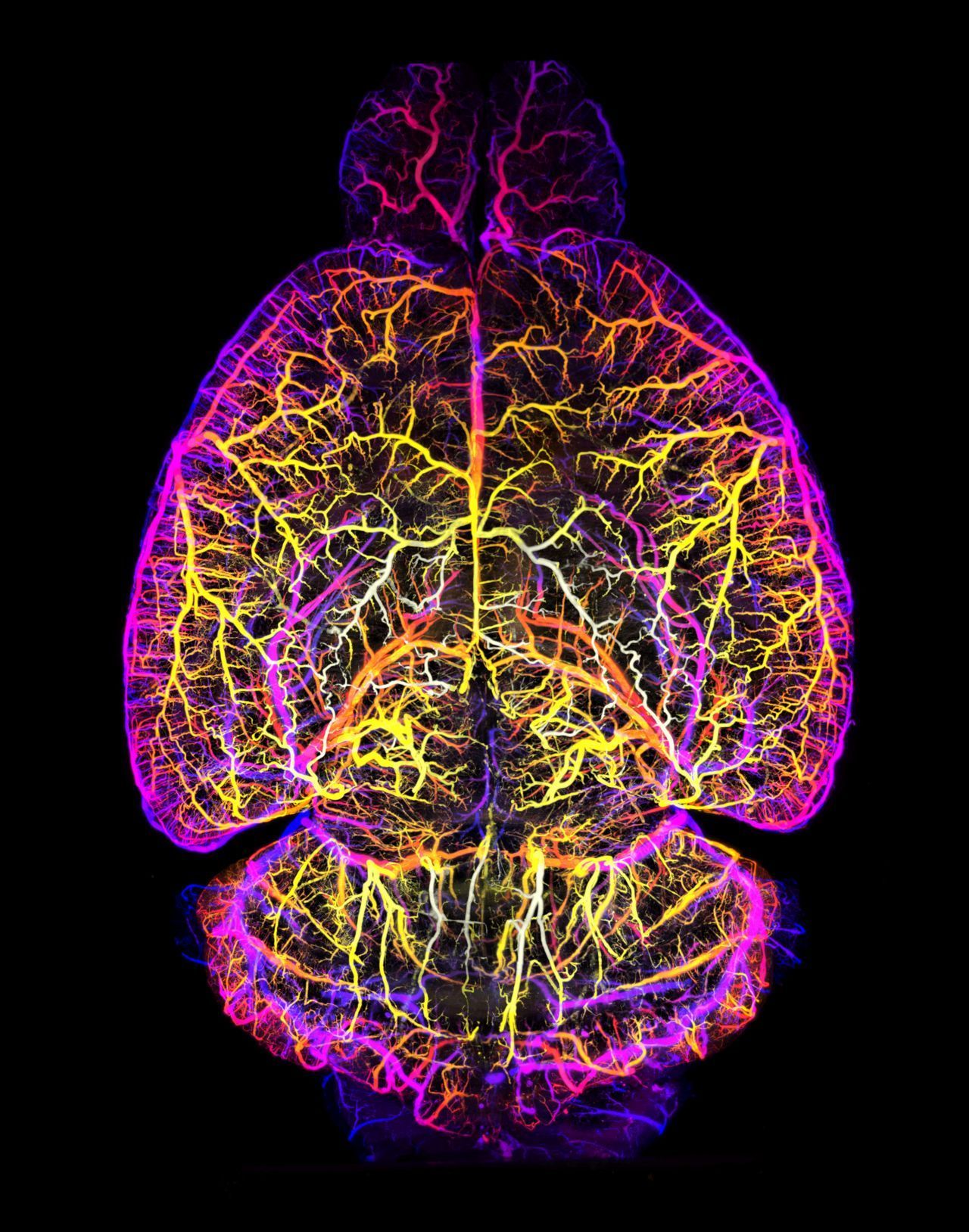 Hier siehst du das Gehirn mit seinem Gefäßsystem.