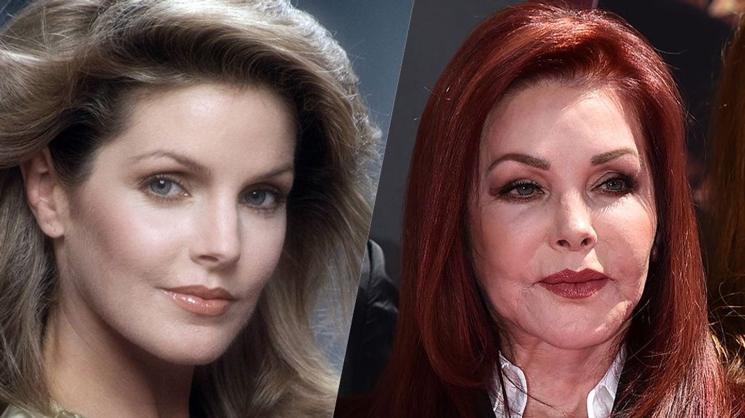 Bei Priscilla Presley sind die Spuren zahlreicher OPs deutlich zu sehen.