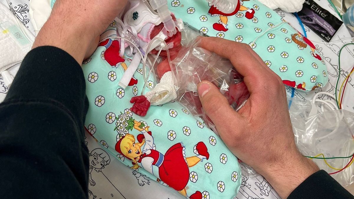 Frühgeborenes Mädchen mit 265 Gramm in Passau zur Welt gekommen