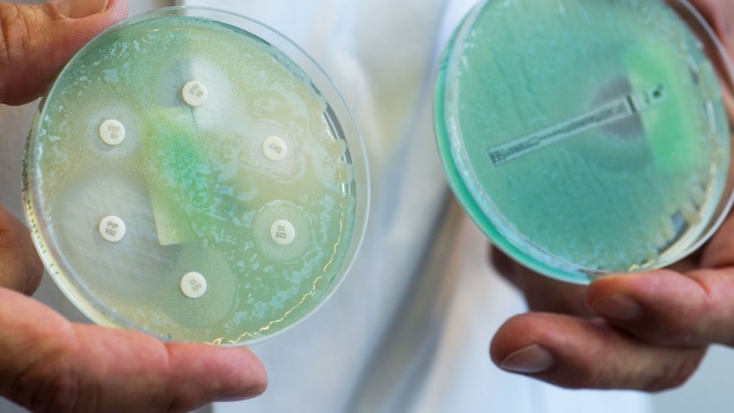 Antibiotikaresistente Bakterien: Liegt die Lösung dazu bei unseren Vorfahren - den Neandertalern?