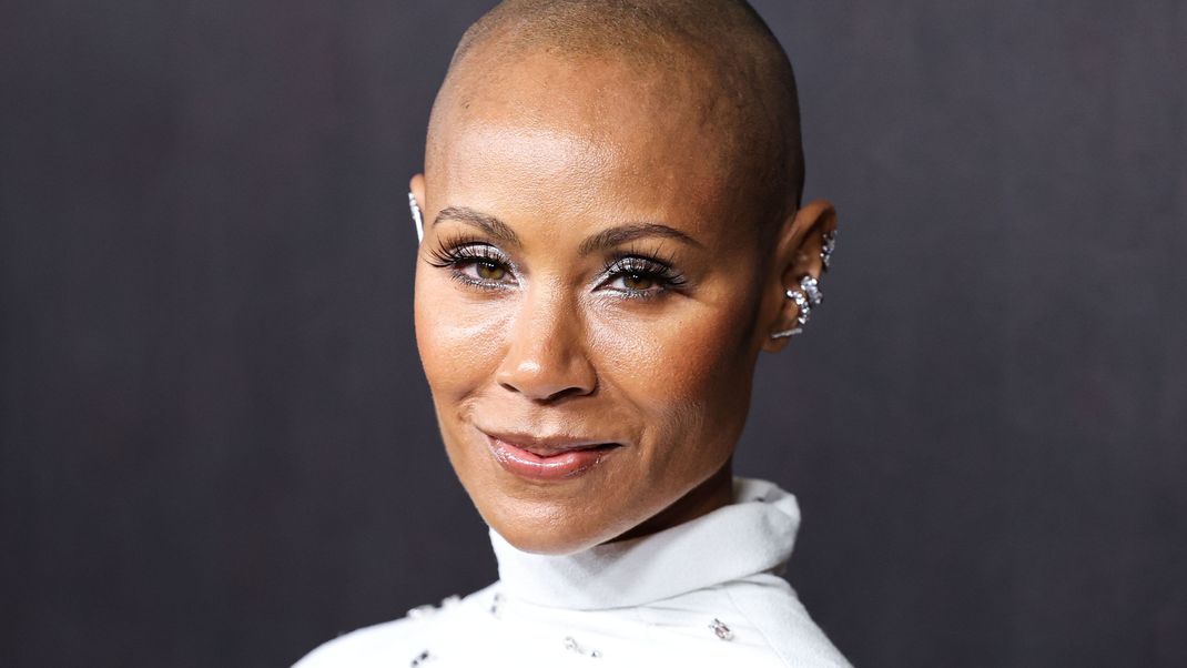 Schauspielerin Jada Pinkett Smith trägt ihre Haare aufgrund der Krankheit Alopecia areata kurz.