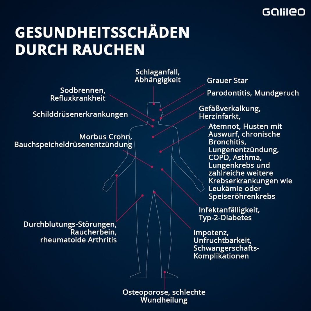 Gesundheitsschäden durch Rauchen: Das sind die Folgen für den Körper.