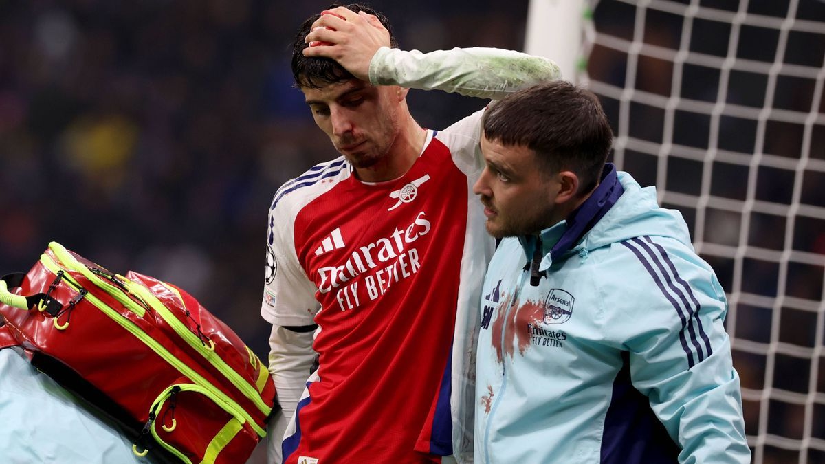 Internazionale v Arsenal - UEFA Champions League - League Stage - San Siro Arsenal s Kai Havertz holds his head as he leaves the field after suffering a cut to his head during the UEFA Champions Le...