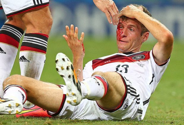 
                <strong>Thomas Müller (Deutsche Nationalmannschaft)</strong><br>
                In der Nachspielzeit des zweiten Gruppenspiels gegen Ghana kommt es zum Kopfballduell zwischen Thomas Müller und John Boye. Der leidtragende war der Deutsche: Ein fetter Cut ziert seine Augenbraue. Doch Müller war nicht der einzige blutige Kämpfer...
              