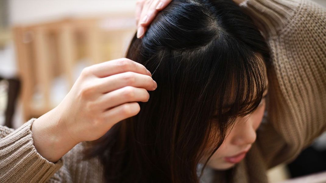 Wie entsteht trockene Kopfhaut und was könnt ihr dagegen tun? Hier findet ihr effektive Pflegetipps, die wirklich helfen!