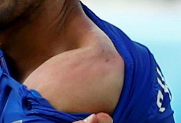 
                <strong>Luis Suarez beißt wieder zu</strong><br>
                In der Schulter von Chiellini hinterließ Suarez im Sommer 2014 ein deutlichen Abdruck. Die große Frage ist, ob es am 6. Juni in Berlin zu einer erneuten Attacke des Uruguayers kommen wird.
              