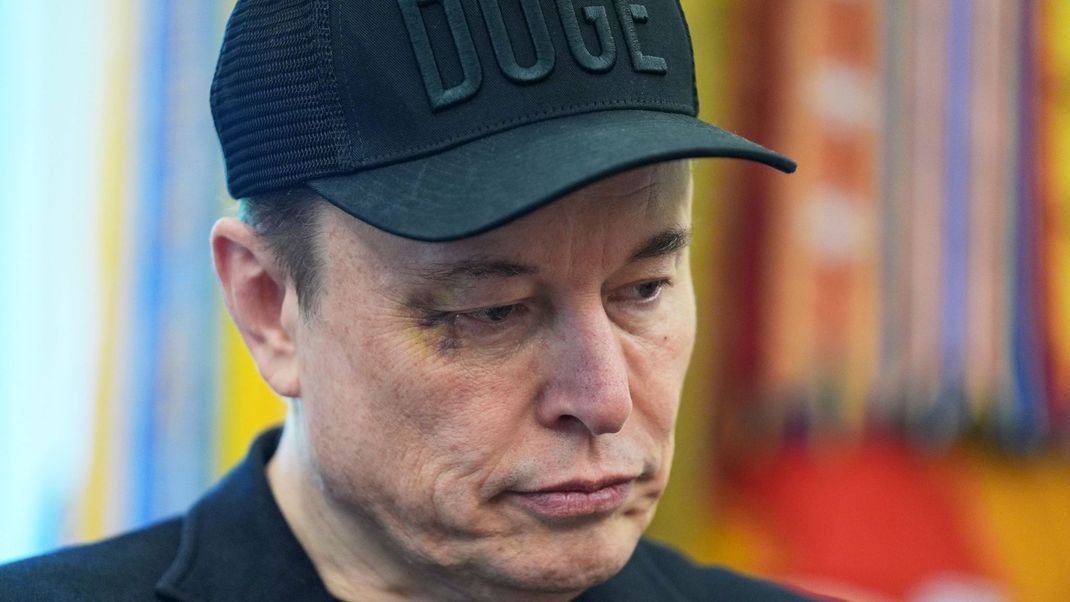 Elon Musk mit blauem Auge am 30. Mai 2025 bei einer gemeinsamen Pressekonferenz mit US-Präsident Donald Trump im Oval Office des Weißen Hauses.