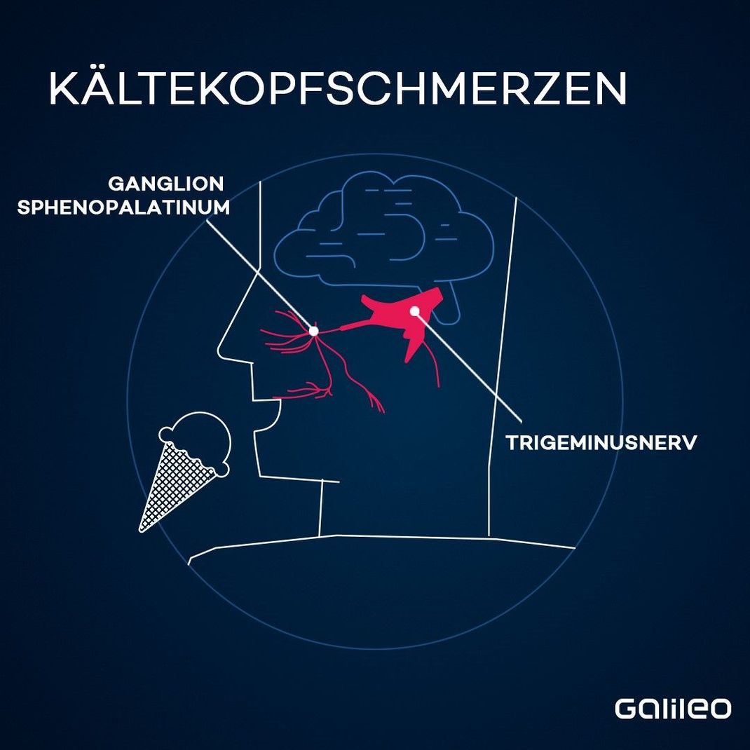 Sowohl der Trigeminusnerv als auch das Ganglion sphenopalatinum werden in Verbindung mit Hirnfrost gebracht. Beide verlaufen in unserem Gesicht.