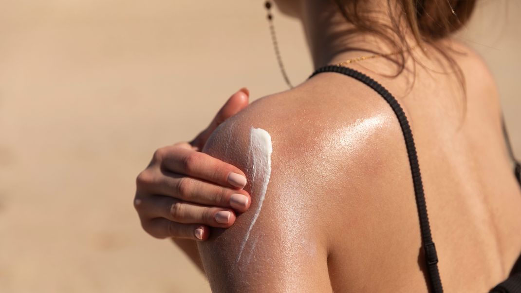 Rötungen, Pusteln und Quaddeln: Was bei einer Sonnen-Allergie und Mallorca-Akne wirklich hilft!