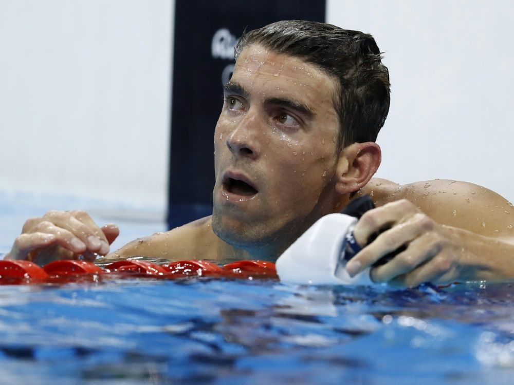 Schwimmstar Phelps lüftet Geheimnis seiner braunen Flecken