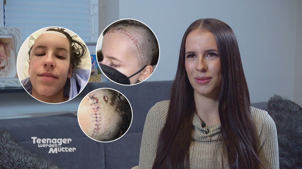 "Ich war drei Tage im Koma!": Jungmama Maja erzählt über ihren tragischen Unfall