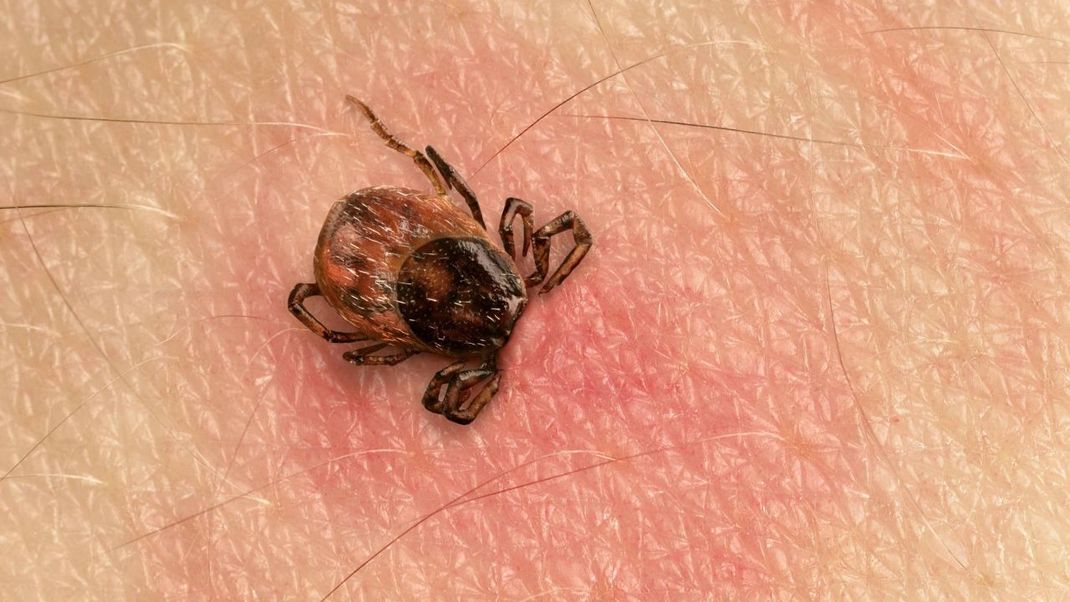 Durch einen Zeckenbiss können Krankheiten wie FSME oder Borreliose übertragen werden.