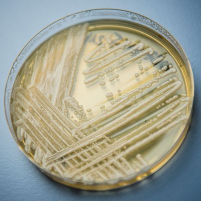 Krankenhaus-Pilz Candidozyma auris