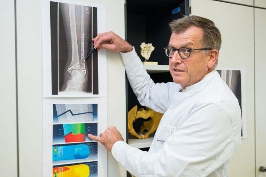 Professor Tim Pohlemann zeigt das neuartige Implantat.