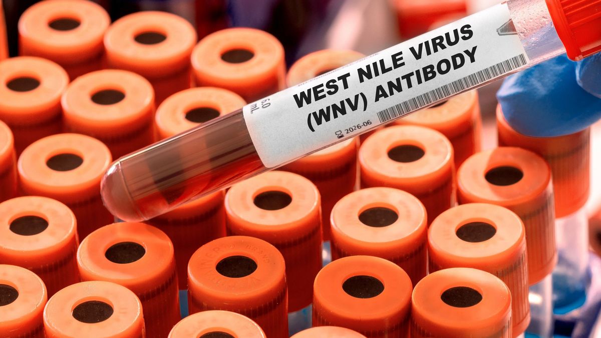 West Nile Virus (WNV) Antibody Test tube with blood sample in infection lab