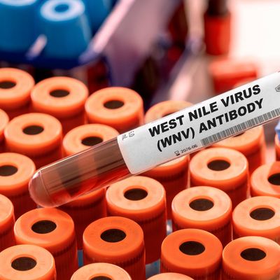 West Nile Virus (WNV) Antibody Test tube with blood sample in infection lab