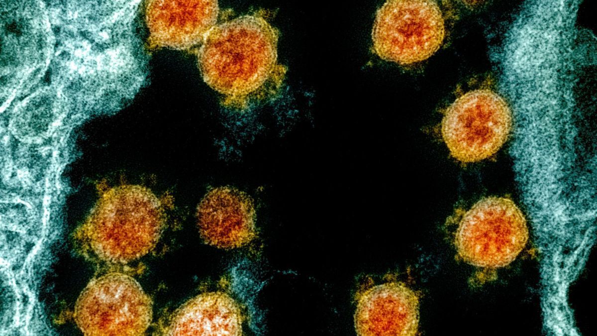 Partikel des Coronavirus' SARS-CoV-2 in einer elektronenmikroskopischen Aufnahme des National Institute of Allergy and Infectious Diseases Integrated Research Facility