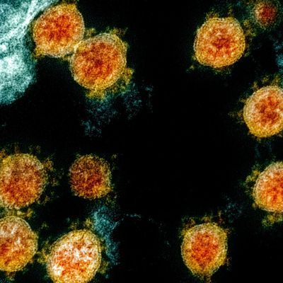 Partikel des Coronavirus' SARS-CoV-2 in einer elektronenmikroskopischen Aufnahme des National Institute of Allergy and Infectious Diseases Integrated Research Facility