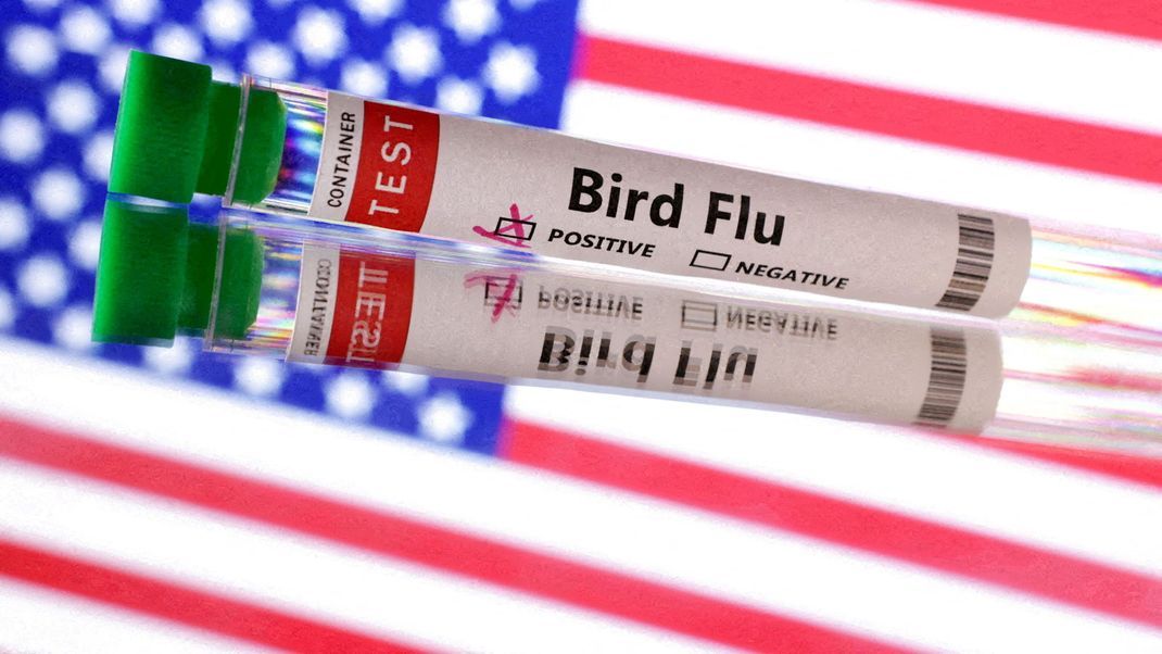 Mutationen des Vogelgrippevirus H5N1 in den USA bei einem Patienten gefunden