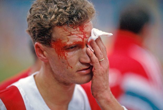
                <strong>Thomas von Heesen (Hamburger SV)</strong><br>
                Auch Thomas von Heesen hat's während seiner aktiven Karriere beim HSV erwischt.
              