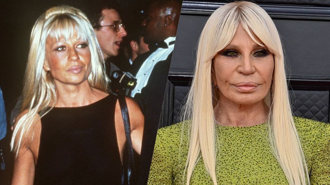 Hat ein Faible für Beauty-Behandlungen: Donatella Versace