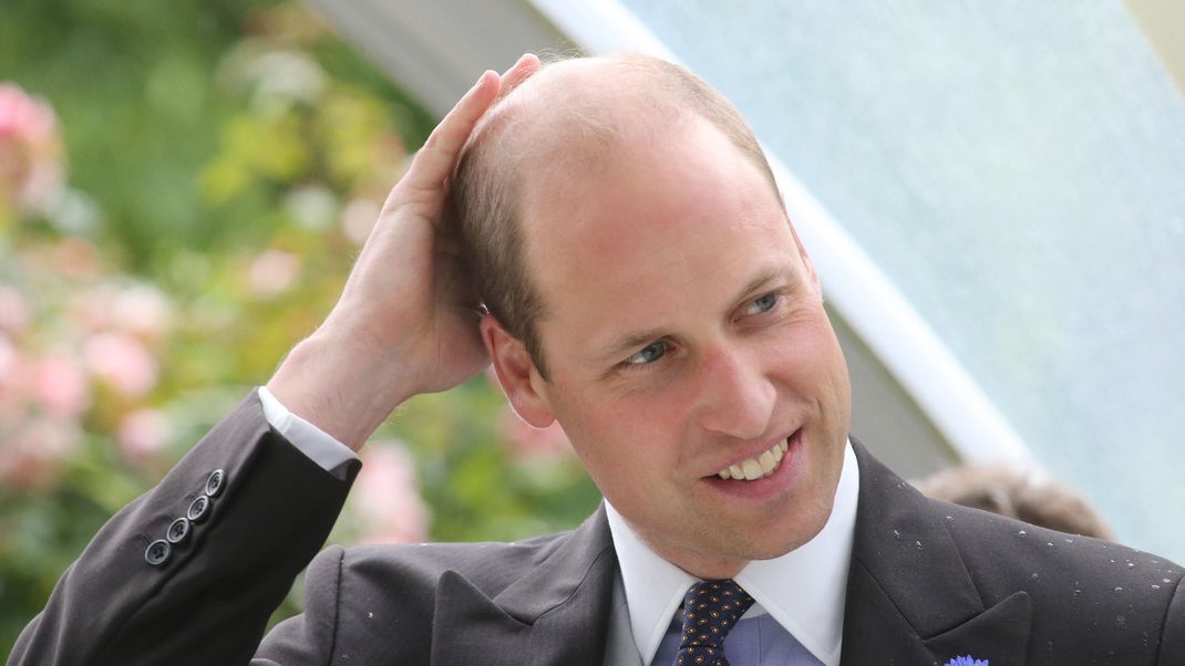 Da ist sie: die heißeste Promi-Glatze. Prinz William trägt seine Glatze mit Stolz. Aber nicht alle finden, dass er den Titel verdient hat. Warum? Das erfährst du hier!