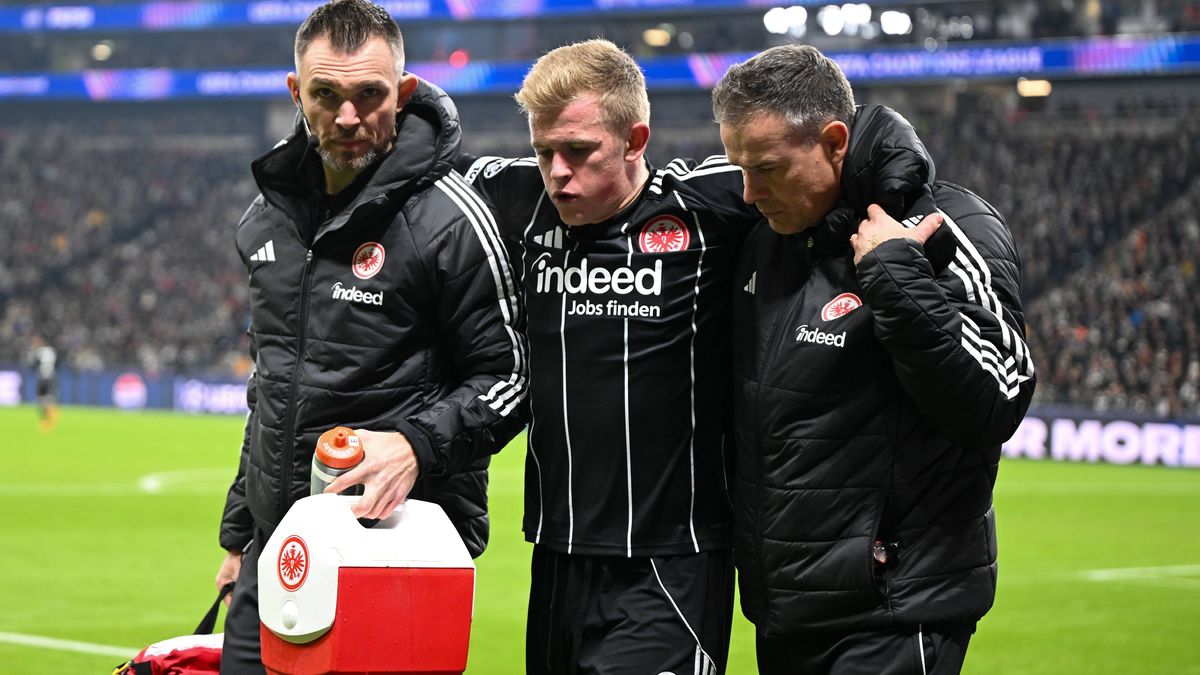 Jonathan Burkardt (Eintracht Frankfurt, 09) muss verletzt den Platz verlassen, GER, Eintracht Frankfurt vs Atalanta Bergamo, Fussball, UEFA Champions League, Ligaphase, 5. Spieltag, Spielzeit 2025 ...