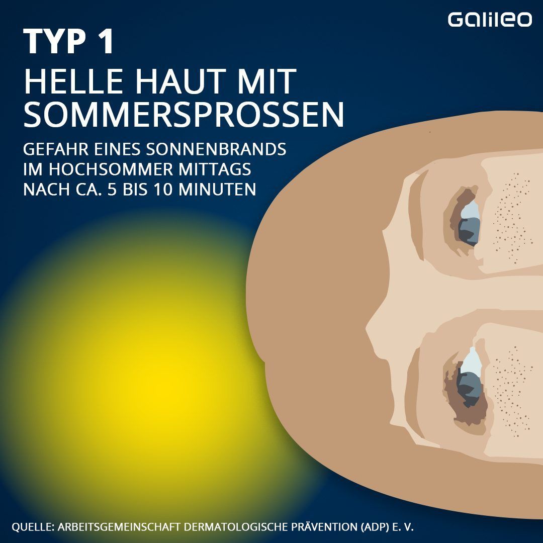 Helle Haut mit Sommersprossen