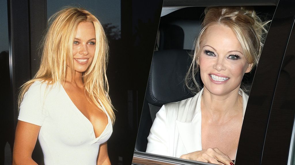 Gefärbte Haare und gemachte Brüste kamen zu Beginn, inzwischen hat Pamela Anderson aber noch mehr machen lassen.