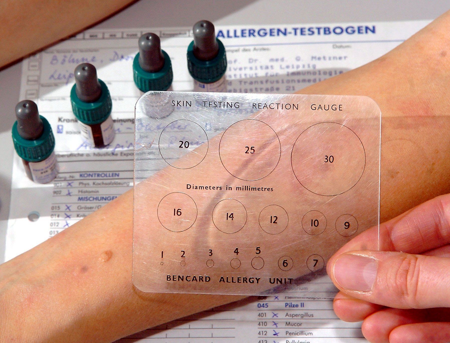 Allergietest: Pricktest und Epikutantest - SAT.1 Ratgeber