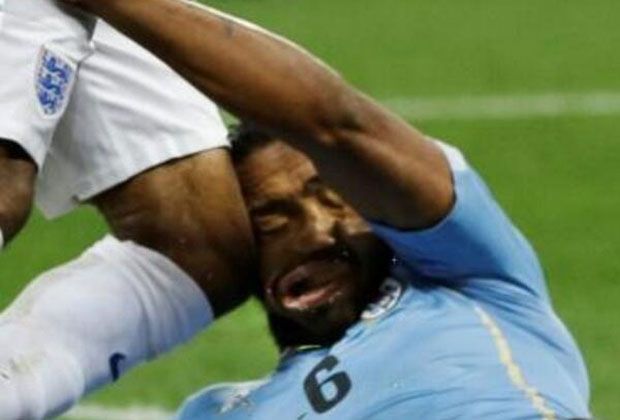 
                <strong>Hart, härter, Alvaro Pereira</strong><br>
                Wie heftig der Zusammenprall zwischen Sterlings Knie und Pereiras Kopf war, zeigt dieses Bild. 
              